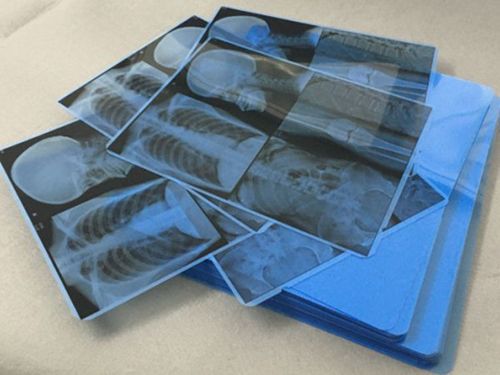 Película médica azul de inyección de tinta